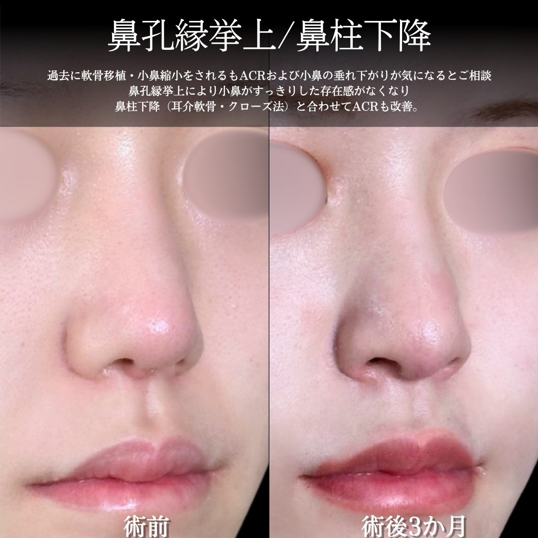 No.16499の症例写真1